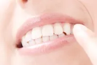 リンガルアーチ